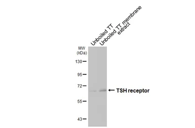 Anti-TSH receptor antibody [HL3874] used in Western Blot (WB). GTX642112