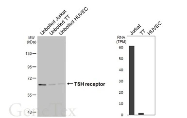 Anti-TSH receptor antibody [HL3874] used in Western Blot (WB). GTX642112