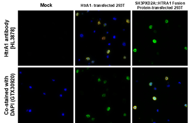 Anti-HtrA1 antibody [HL3878] used in IHC-P (cell pellet) (IHC-P (cell pellet)). GTX642116