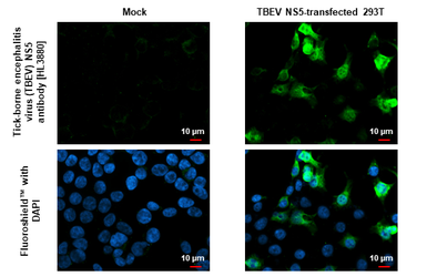 Anti-Tick-borne encephalitis virus (TBEV) NS5 antibody [HL3880] used in Immunocytochemistry/ Immunofluorescence (ICC/IF). GTX642118