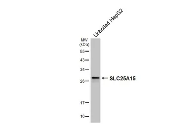 Anti-SLC25A15 antibody [HL3883] used in Western Blot (WB). GTX642124