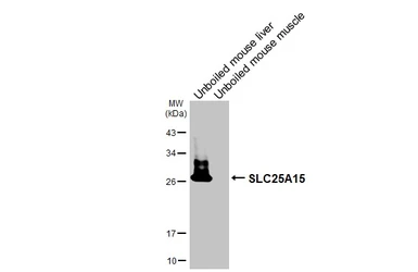 Anti-SLC25A15 antibody [HL3883] used in Western Blot (WB). GTX642124