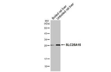 Anti-SLC25A15 antibody [HL3883] used in Western Blot (WB). GTX642124