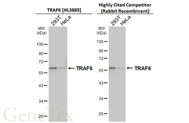 Anti-TRAF6 antibody [HL3885] used in Western Blot (WB). GTX642126