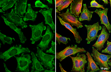 Anti-TRAF6 antibody [HL3886] used in Immunocytochemistry/ Immunofluorescence (ICC/IF). GTX642127