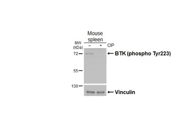 Anti-BTK (phospho Tyr223) antibody [HL3887] used in Western Blot (WB). GTX642128