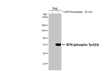 Anti-BTK (phospho Tyr223) antibody [HL3887] used in Western Blot (WB). GTX642128