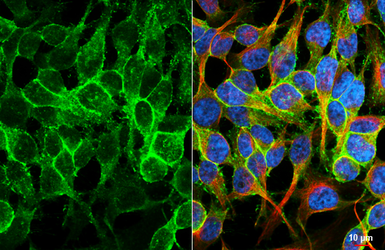 Anti-BASP1 antibody [HL3888] used in Immunocytochemistry/ Immunofluorescence (ICC/IF). GTX642129