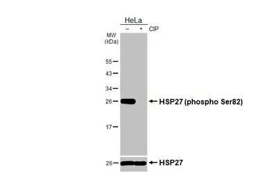 Anti-HSP27 (phospho Ser82) antibody [HL3889] used in Western Blot (WB). GTX642130