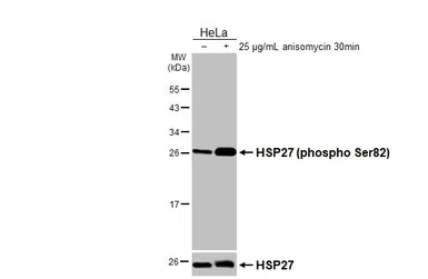 Anti-HSP27 (phospho Ser82) antibody [HL3889] used in Western Blot (WB). GTX642130