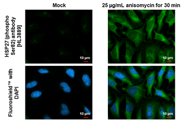 Anti-HSP27 (phospho Ser82) antibody [HL3889] used in Immunocytochemistry/ Immunofluorescence (ICC/IF). GTX642130