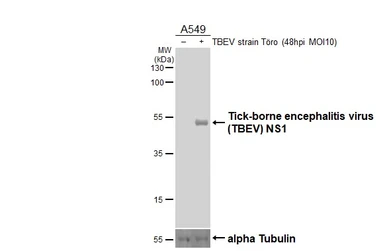 Anti-Tick-borne encephalitis virus (TBEV) NS1 antibody [HL3903] used in Western Blot (WB). GTX642144