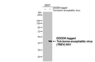 Anti-Tick-borne encephalitis virus (TBEV) NS1 antibody [HL3904] used in Western Blot (WB). GTX642145