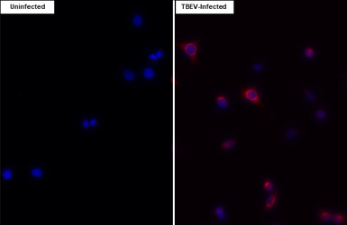 Anti-Tick-borne encephalitis virus (TBEV) NS1 antibody [HL3904] used in Immunocytochemistry/ Immunofluorescence (ICC/IF). GTX642145