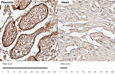 Anti-EFEMP1 antibody [HL3907] used in IHC (Paraffin sections) (IHC-P). GTX642148