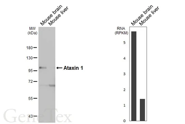 Anti-Ataxin 1 antibody [GT106] used in Western Blot (WB). GTX642154
