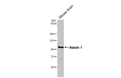 Anti-Ataxin 1 antibody [GT106] used in Western Blot (WB). GTX642154