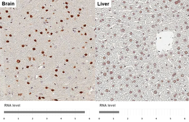 Anti-Ataxin 1 antibody [GT106] used in IHC (Paraffin sections) (IHC-P). GTX642154