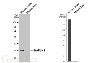 Anti-HAPLN2 antibody [GT107] used in Western Blot (WB). GTX642155