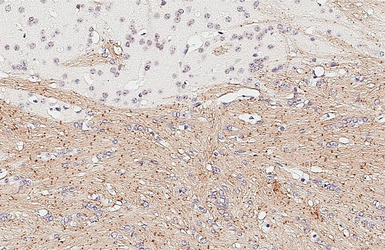 Anti-HAPLN2 antibody [GT107] used in IHC (Paraffin sections) (IHC-P). GTX642155