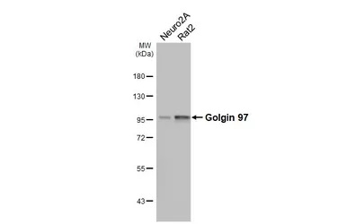 Anti-Golgin 97 antibody [HL3913] used in Western Blot (WB). GTX642158