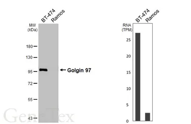 Anti-Golgin 97 antibody [HL3913] used in Western Blot (WB). GTX642158