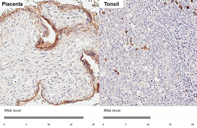Anti-S1PR2 antibody [HL3921] used in IHC (Paraffin sections) (IHC-P). GTX642166