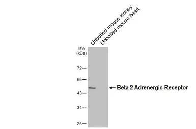 Anti-beta 2 Adrenergic Receptor antibody [HL3929] used in Western Blot (WB). GTX642174