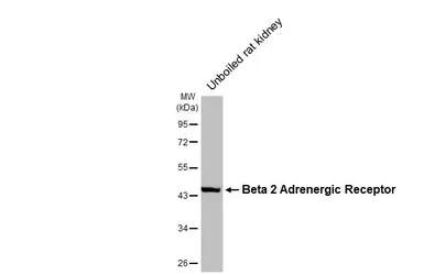 Anti-beta 2 Adrenergic Receptor antibody [HL3929] used in Western Blot (WB). GTX642174