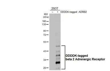 Anti-beta 2 Adrenergic Receptor antibody [HL3929] used in Western Blot (WB). GTX642174