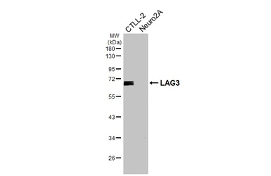 Anti-LAG3 antibody [HL3930] used in Western Blot (WB). GTX642175