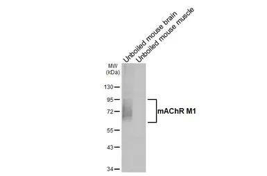 Anti-mAChR M1 antibody [HL3933] used in Western Blot (WB). GTX642178