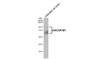 Anti-mAChR M1 antibody [HL3933] used in Western Blot (WB). GTX642178