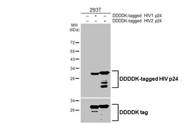 Anti-HIV p24 antibody [HL3937] used in Western Blot (WB). GTX642182