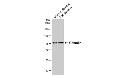 Anti-Gelsolin antibody [HL3943] used in Western Blot (WB). GTX642193