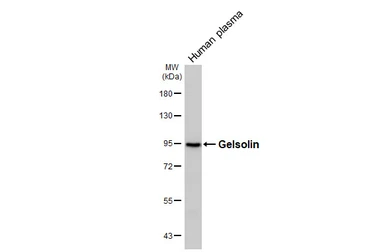 Anti-Gelsolin antibody [HL3943] used in Western Blot (WB). GTX642193
