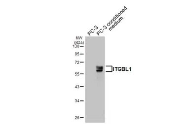 Anti-ITGBL1 antibody [HL3944] used in Western Blot (WB). GTX642194