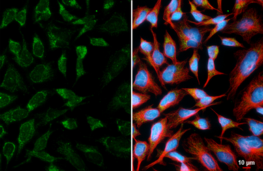 Anti-ATP synthase gamma antibody [HL3949] used in Immunocytochemistry/ Immunofluorescence (ICC/IF). GTX642199