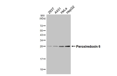Anti-Peroxiredoxin 6 antibody [HL3951] used in Western Blot (WB). GTX642201