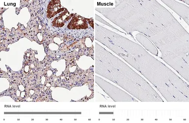 Anti-Peroxiredoxin 6 antibody [HL3951] used in IHC (Paraffin sections) (IHC-P). GTX642201