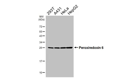 Anti-Peroxiredoxin 6 antibody [HL3952] used in Western Blot (WB). GTX642202