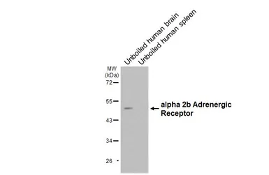 Anti-alpha 2b Adrenergic Receptor antibody [HL3957] used in Western Blot (WB). GTX642207