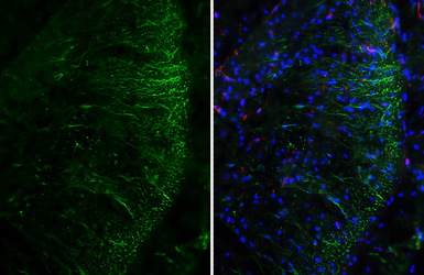 Anti-Adenosine A2b Receptor antibody [HL3959] used in IHC (Frozen sections) (IHC-Fr). GTX642209
