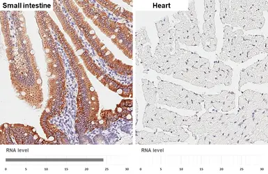 Anti-HKDC1 antibody [HL3961] used in IHC (Paraffin sections) (IHC-P). GTX642211