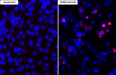 Anti-Powassan virus NS1 antibody [HL3963] used in Immunocytochemistry/ Immunofluorescence (ICC/IF). GTX642213