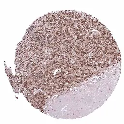 Anti-p27 Kip1 antibody [HMV3970] HistoMAX&trade; used in IHC (Paraffin sections) (IHC-P). GTX642296