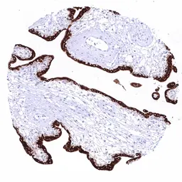Anti-Kiss1 antibody [HMV3972] HistoMAX&trade; used in IHC (Paraffin sections) (IHC-P). GTX642298