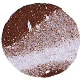 Anti-GPM6A antibody [HMV3973] HistoMAX&trade; used in IHC (Paraffin sections) (IHC-P). GTX642299