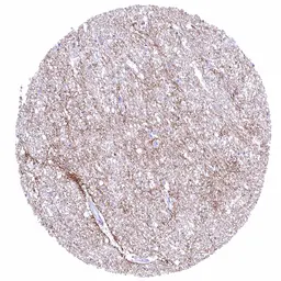 Anti-GPM6A antibody [HMV3973] HistoMAX&trade; used in IHC (Paraffin sections) (IHC-P). GTX642299