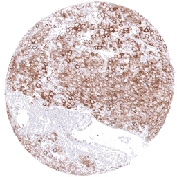Anti-GPM6A antibody [HMV3973] HistoMAX&trade; used in IHC (Paraffin sections) (IHC-P). GTX642299